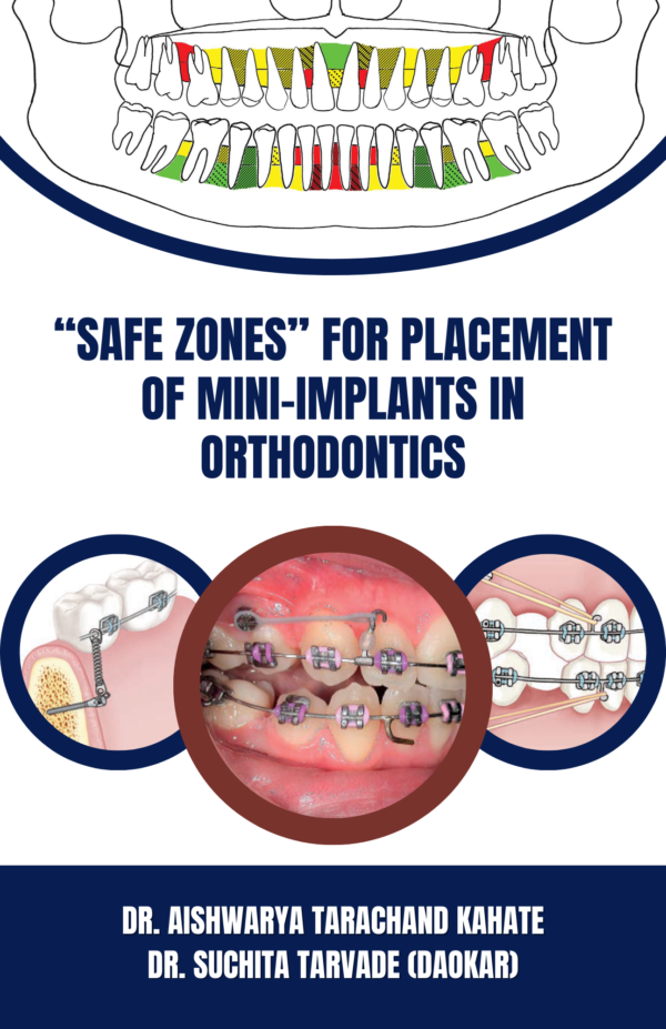 “SAFE ZONES” FOR PLACEMENT OF MINI-IMPLANTS IN ORTHODONTICS